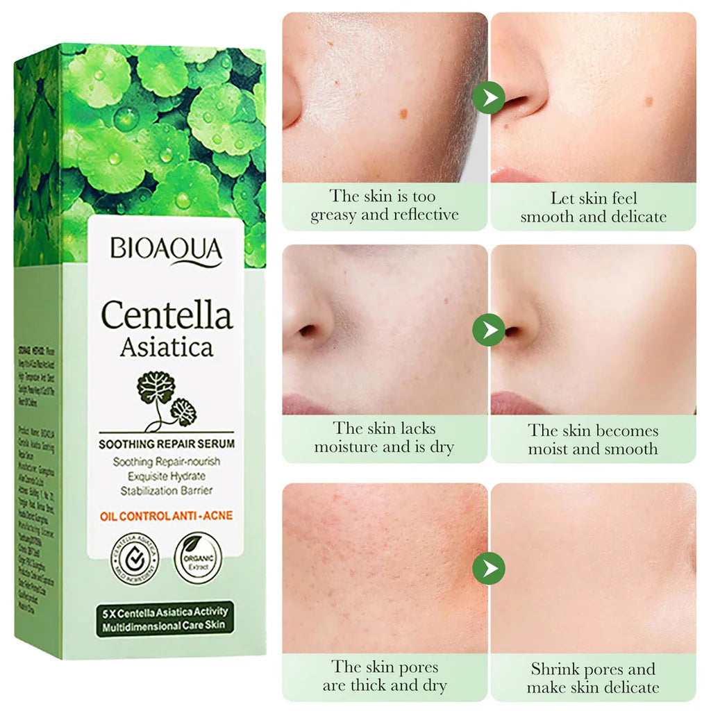 BIOAQUA Centella Asiatica Soothing Repair Facial Serum 30ml
